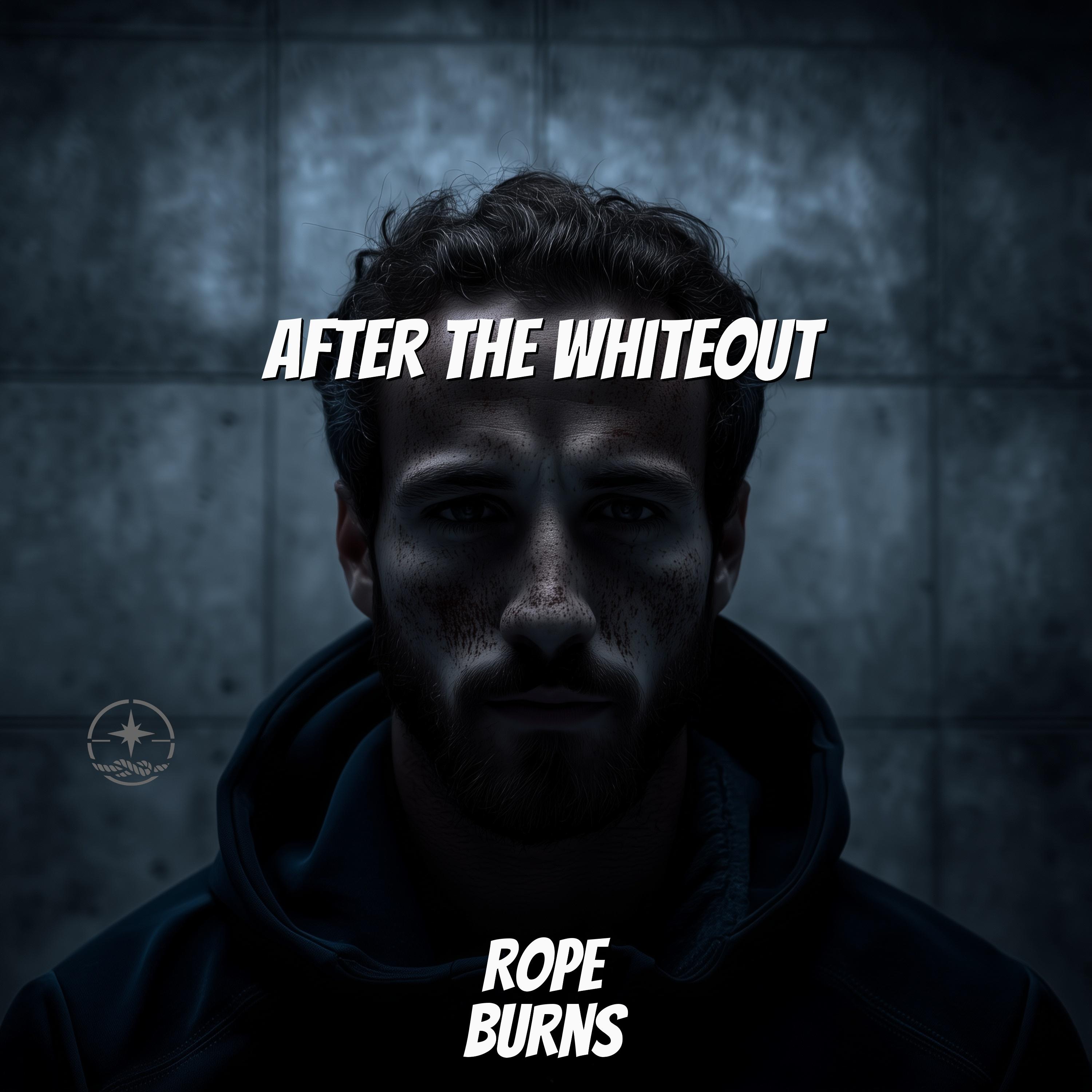 Rope Burns